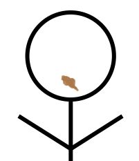 Artist's Rendering of Fecal Soul Patch